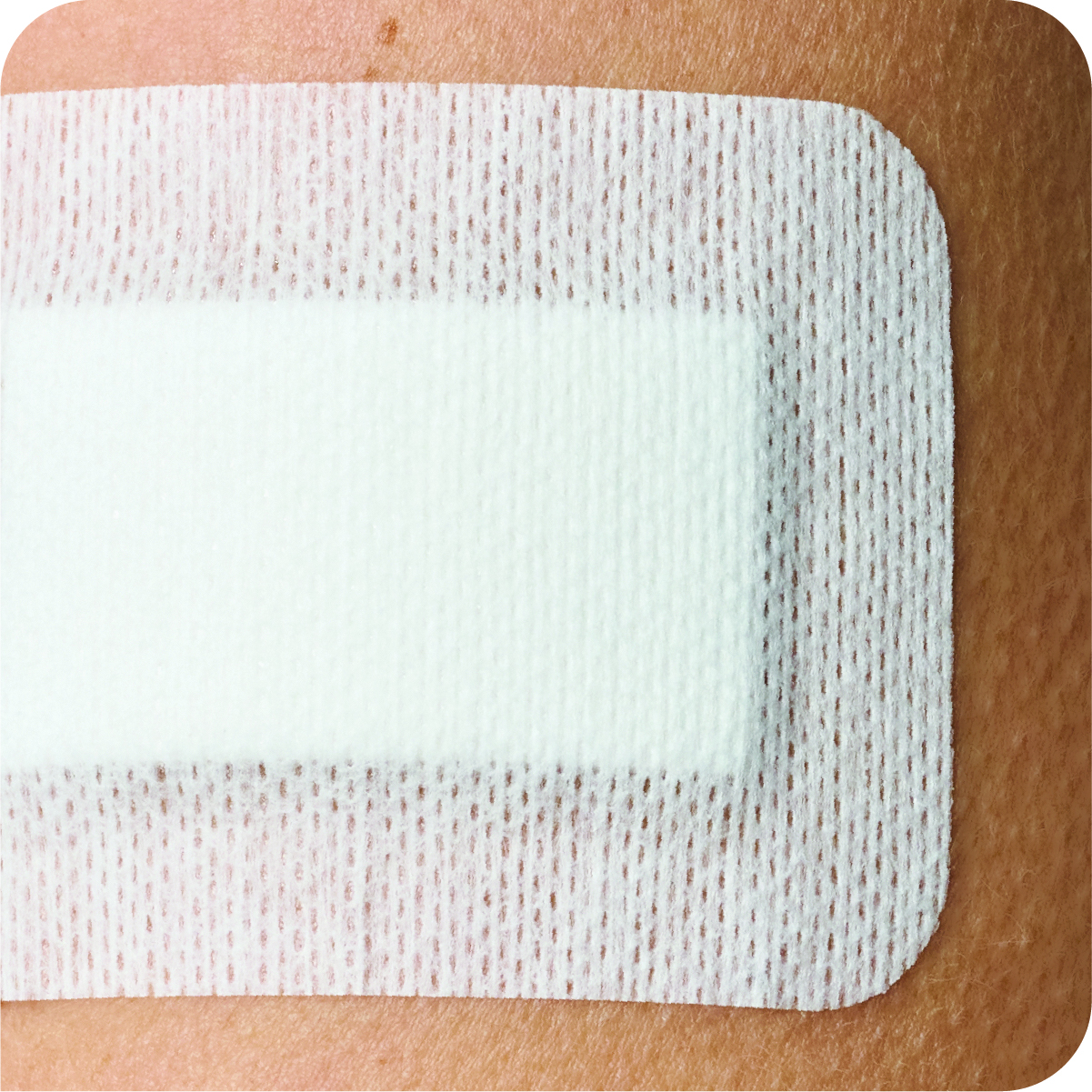 Aero Healthcare Aerofix Non-Woven Island Dressings 10 x 15 cm, White, 20 Count (Pack of 2)