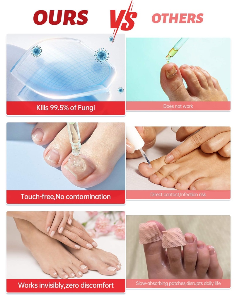 toenail-fungus-treatment-extra-strength--4.jpg