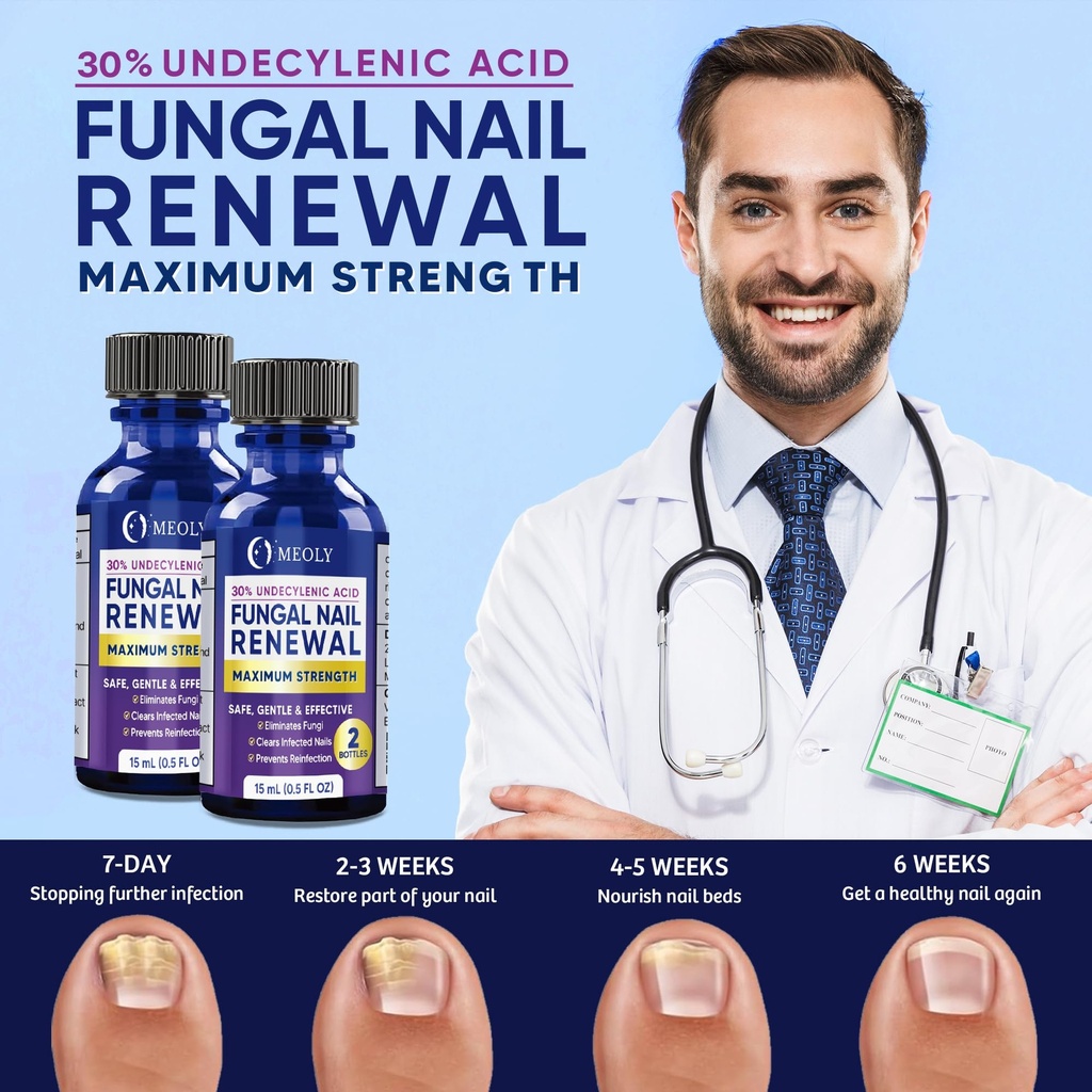 meoly-toenail-fungus-treatment-30-undecy-2.jpg