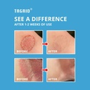 tagrid-antifungal-jock-itch-cream-jock-i-2.jpg