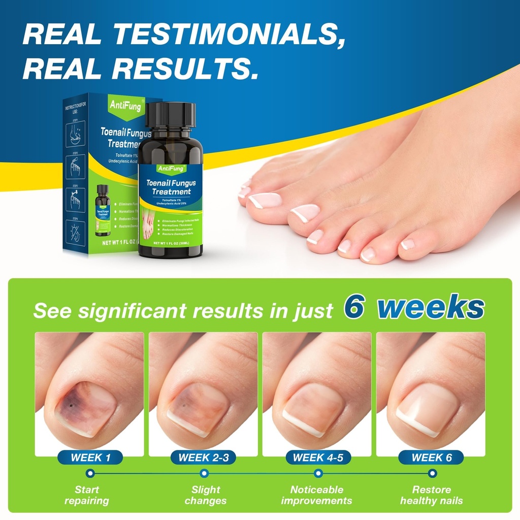 toenail-fungus-treatment-extra-strength--2.jpg