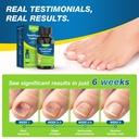 toenail-fungus-treatment-extra-strength--3.jpg