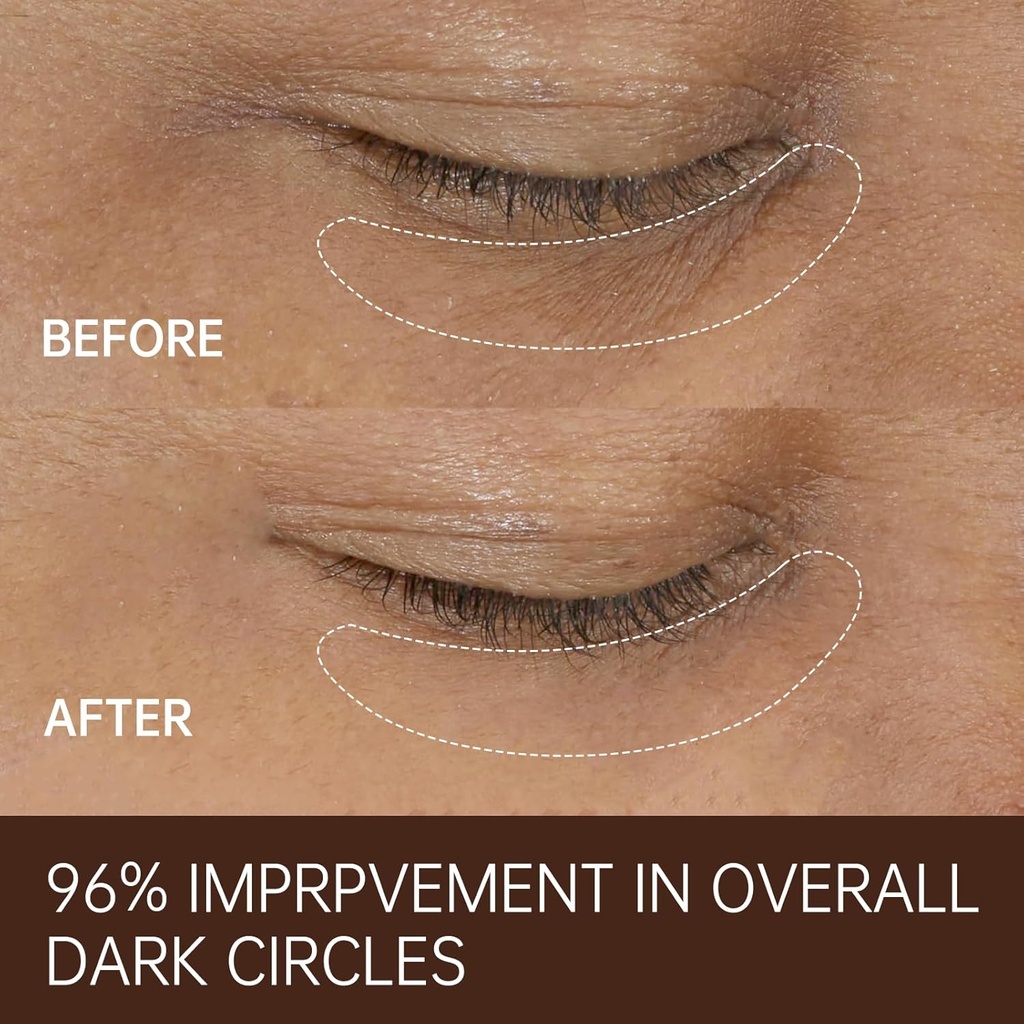 freemood-eye-cream-for-dark-circlesanti--5.jpg