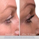 obagi-nu-cil-eyelash-enhancing-serum-nou-6.jpg