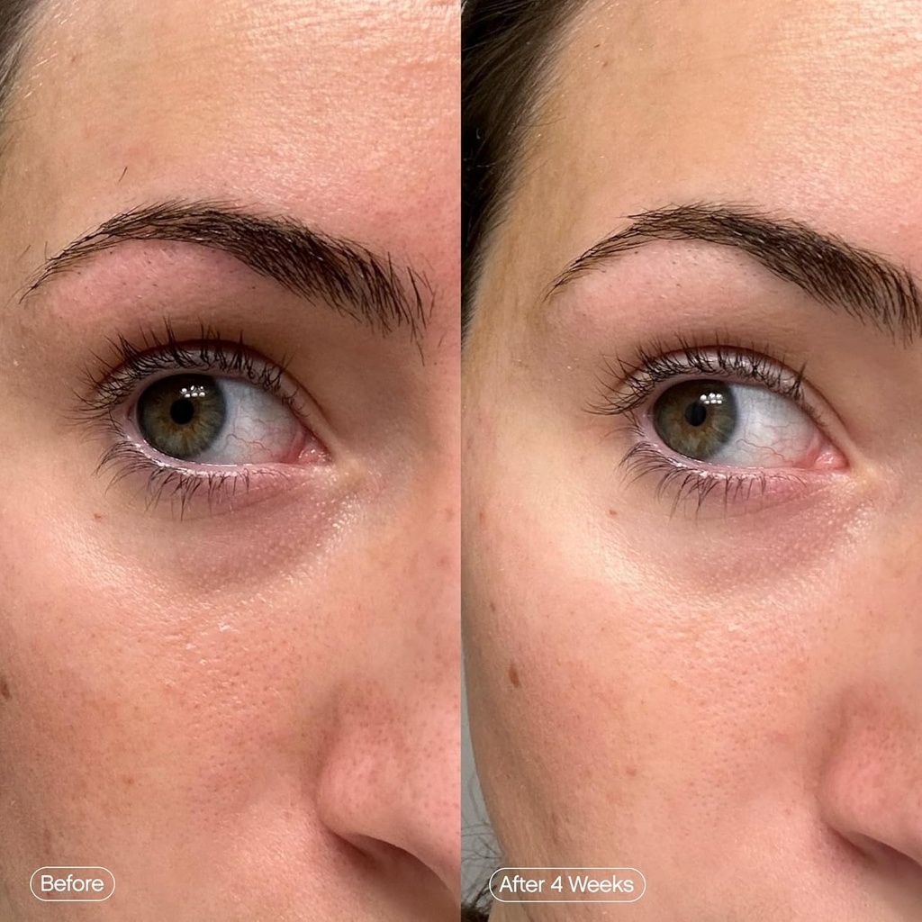 topicals-faded-brightening-under-eye-mas-5.jpg