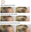 kerohair-complete-supplement-with-vitami-3.jpg
