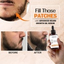 nourish-mantra---advanced-beard-growth-o-6.jpg