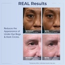plexaderm-rapid-reduction-eye-serum---vi-6.jpg