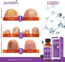 toenail-fungus-revitalizer-for-toenail-f-3.jpg