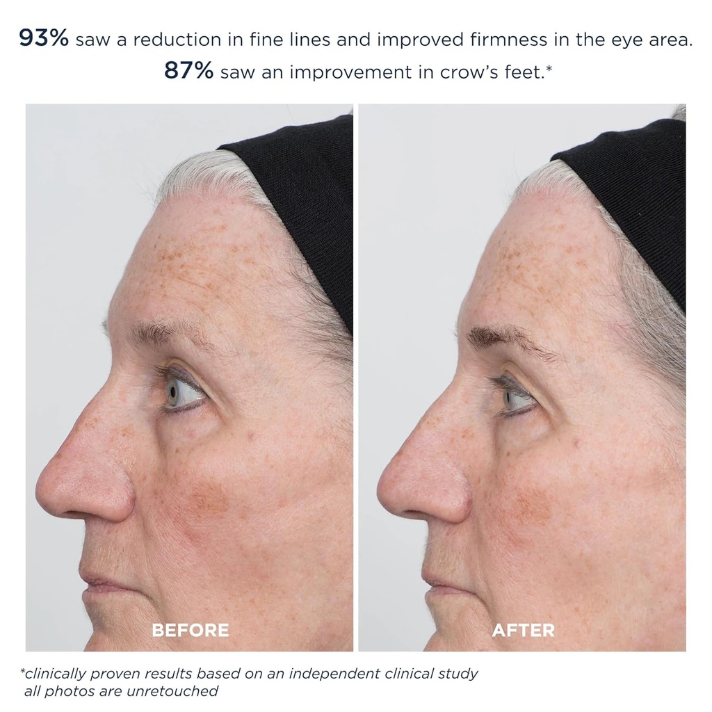 m-61-prosmooth-retinol-eye-serum-01-non--5.jpg