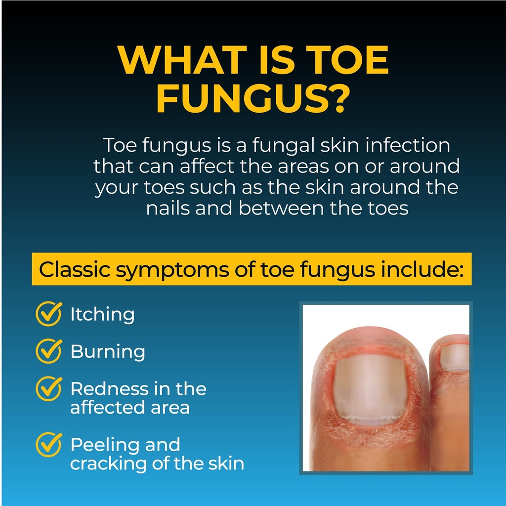 fungi-nail-pen-applicator-anti-fungal-so-5.jpg