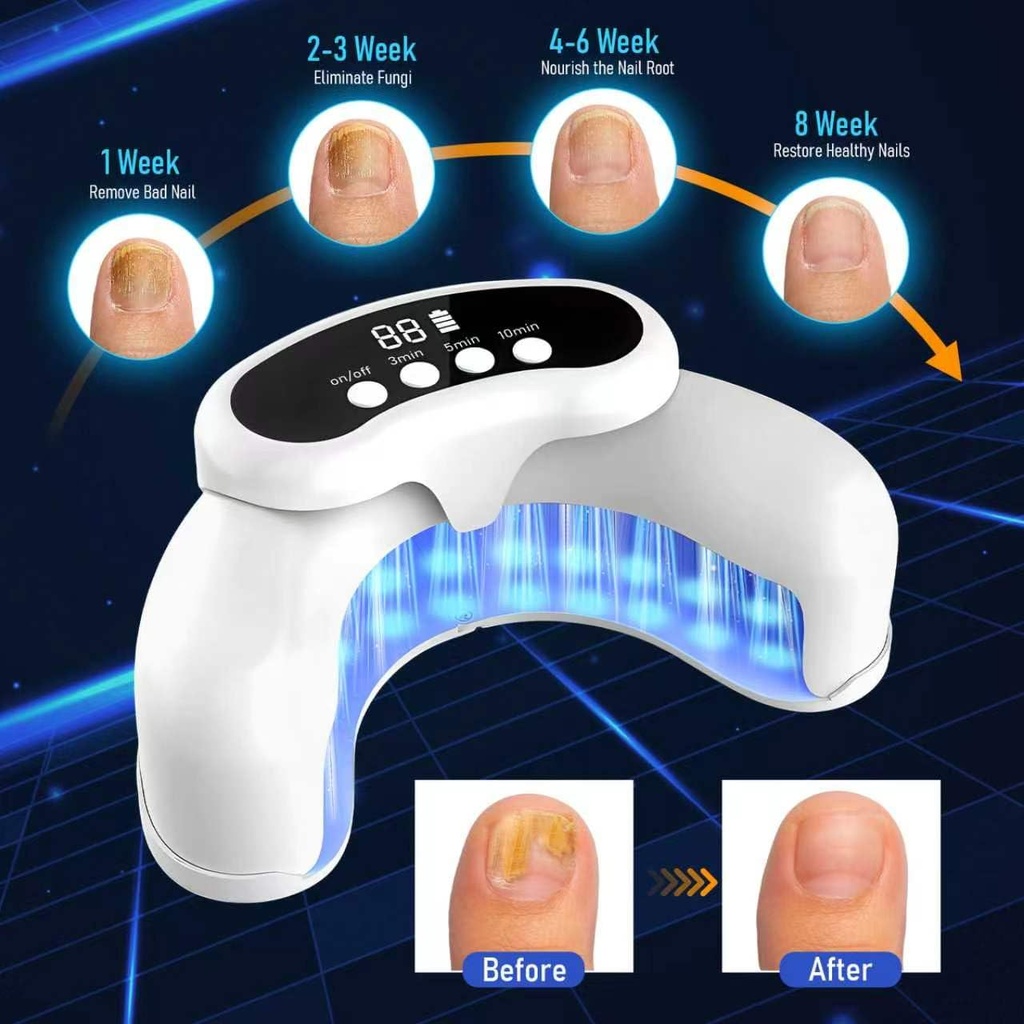 nail-fungus-light-therapy-device-for-toe-3.jpg