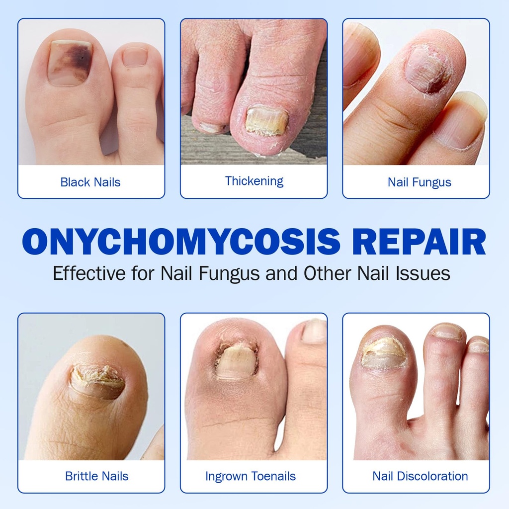 nail-patches-21pcs-toenail-treatment-ext-2.jpg