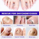 toenail-fungus-treatment-extra-strength--5.jpg