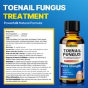 toenail-fungus-treatment-extra-strength--5.jpg