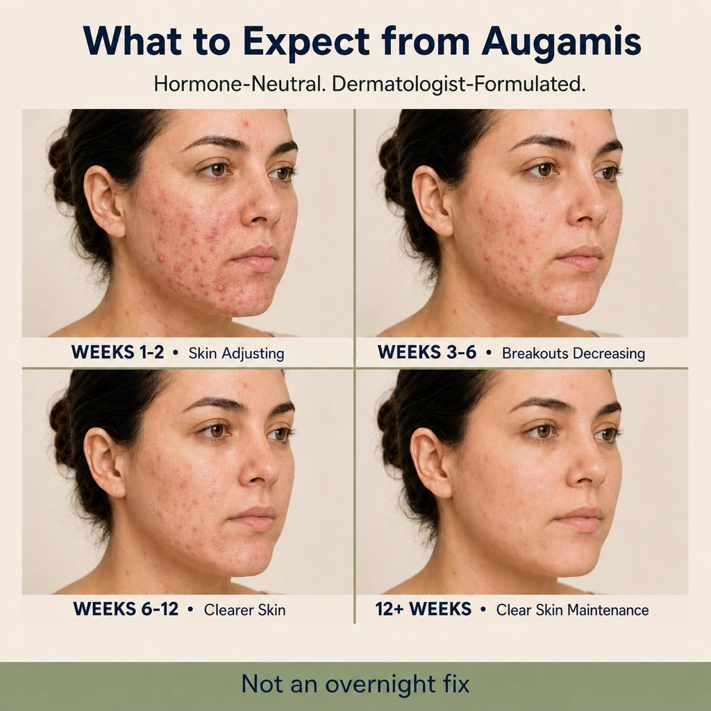 hormonal-acne-treatment-for-women-dim-fr-2.jpg